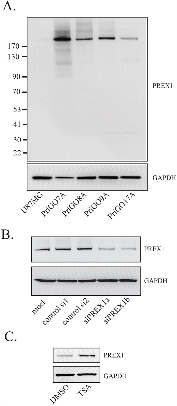 PREX1 expression in glioblastoma cells.
