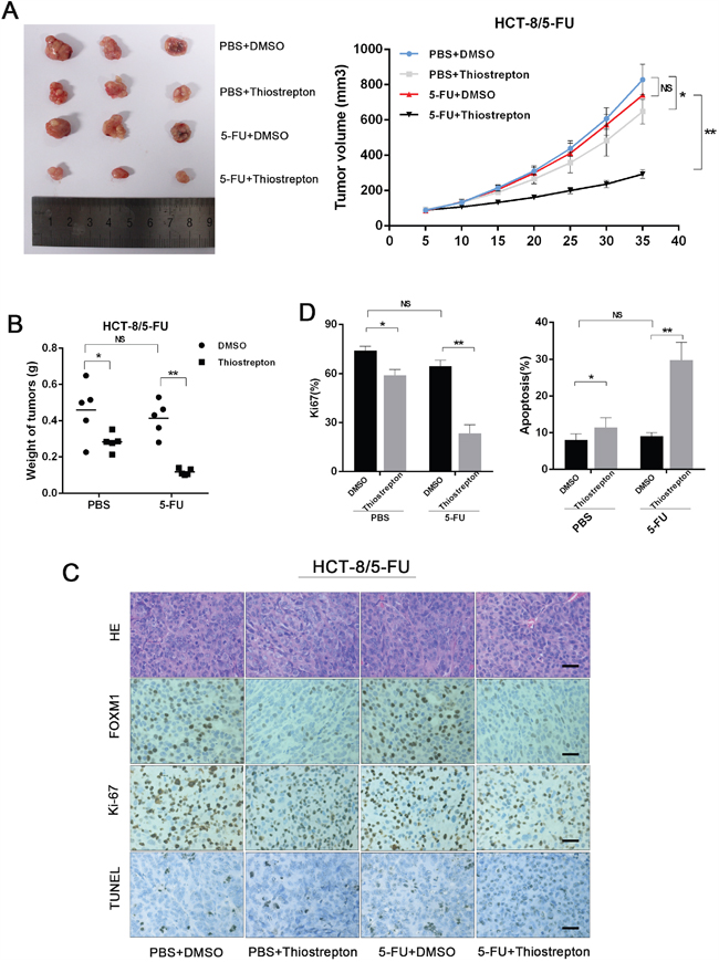 Inhibition of FOXM1 resentisizes resistant CRC to 5-FU in vivo.