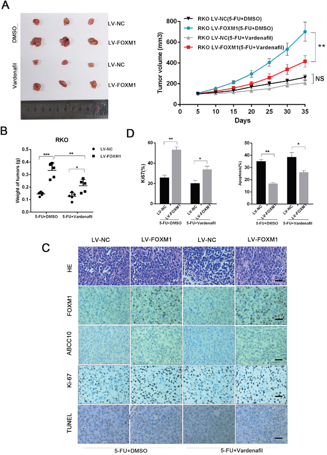 Targeting ABCC10 reverses FOXM1-elicited 5-FU resistance in vivo.
