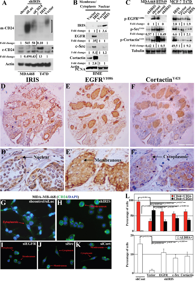 Potential signaling pathway promotes CD24 cytoplasmic confinement in IRISOE TNBC cells.