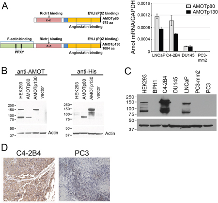 Expression of AMOT isoforms in PCa cell lines.