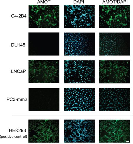 Expression of Amot in PCa cell lines.