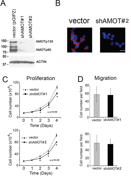 Effect of AMOT knockdown on the proliferation and migration of C4-2B4 cells.