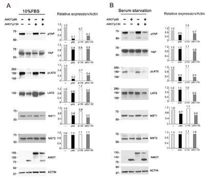 Effect of AMOT on the Hippo-YAP signaling pathway in PC3-mm2 cells.