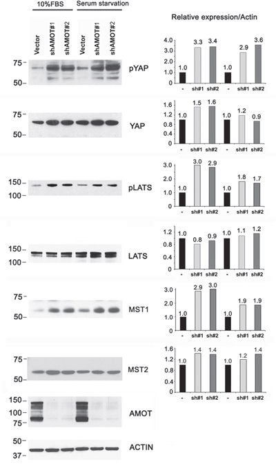 Effect of AMOT on the Hippo-YAP signaling pathway in C4-2B4 cells.