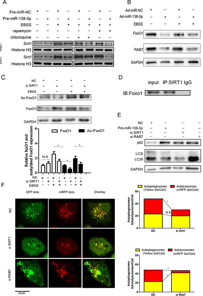 SIRT1 regulates autophagy via the FoxO1/Rab7 pathway.