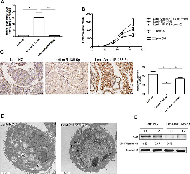 miR-138-5p inhibits autophagy and tumor growth of pancreatic cancer xenografts in vivo.