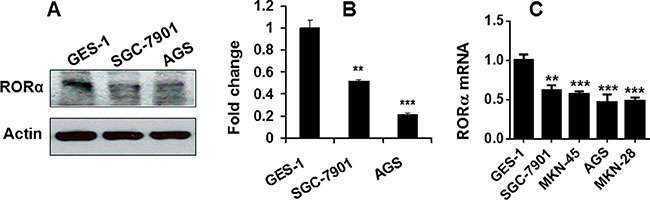 ROR&#x03B1; was reduced in human gastric cancer cell lines.