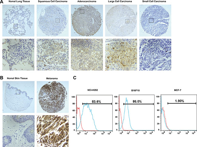 TF expression in human samples and cancer cell lines.