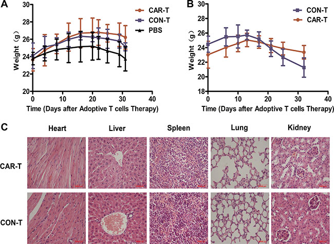 Body weight and pathological analysis of the mice received adoptive cell therapy.