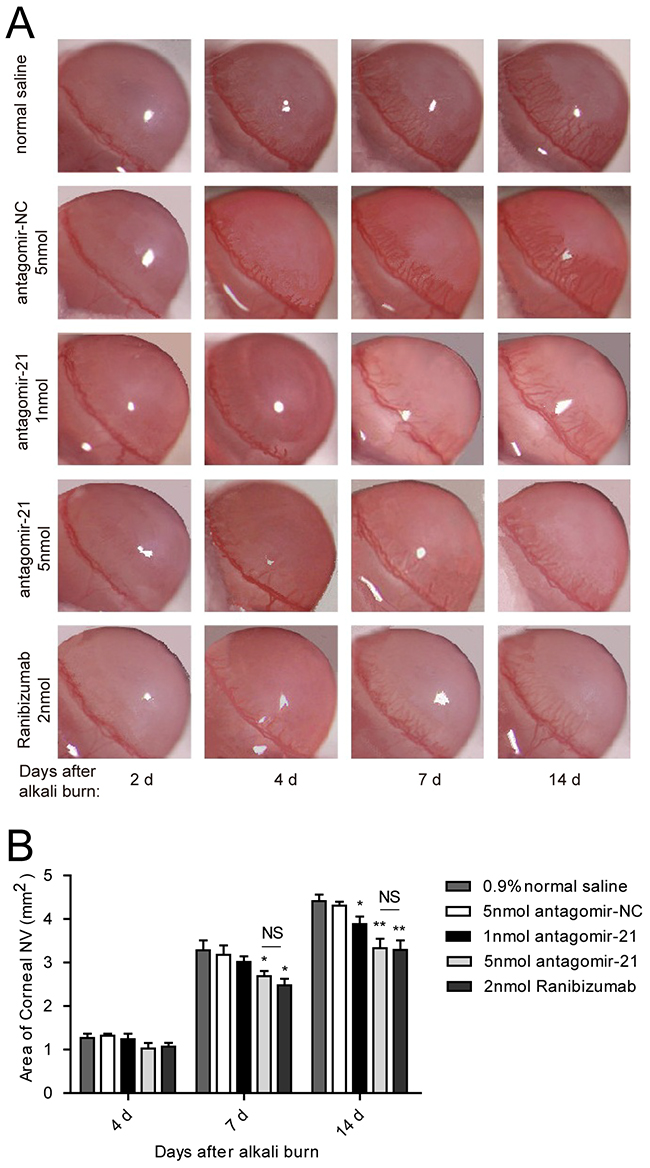 Effect of antagomir-21 on corneal neovascularization in the alkali-burned corneas.