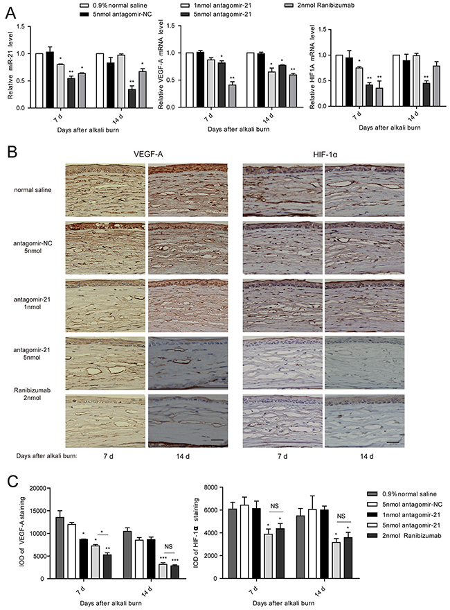 Antagomir-21 effectively suppresses VEGF and HIF-1 expression after corneal alkali burns.