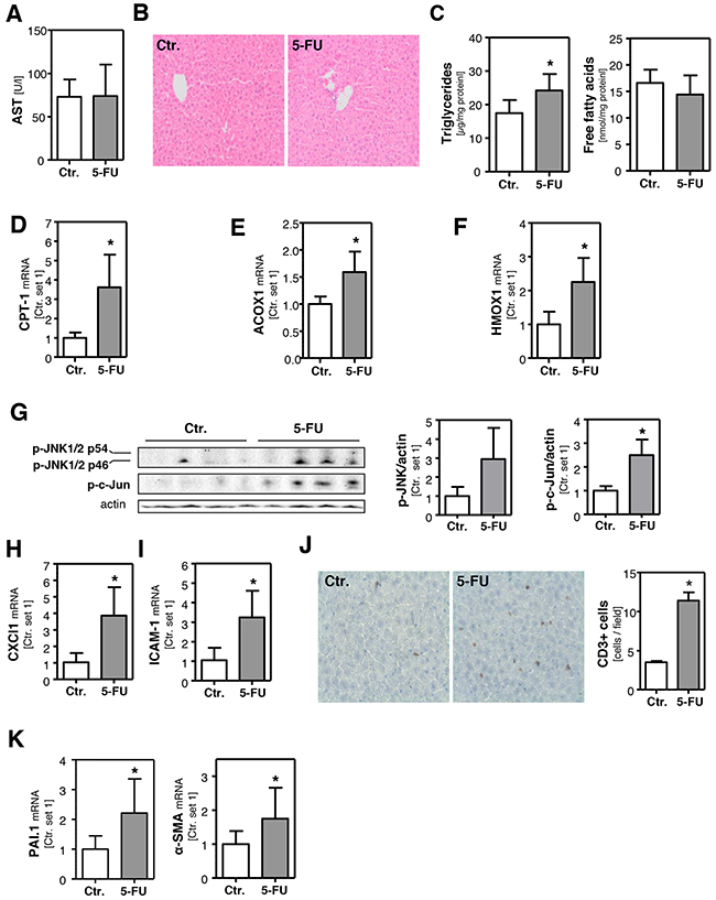 Effect of 5-FU on hepatic steatosis and inflammation in mice.