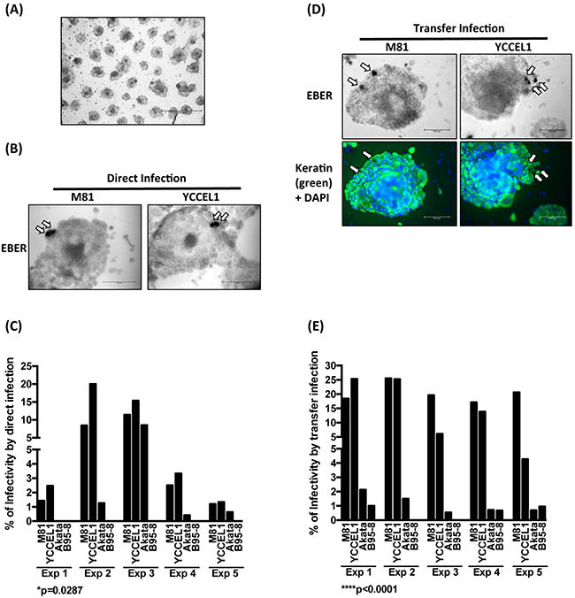 YCCEL1 efficiently infects gastric spheroids.