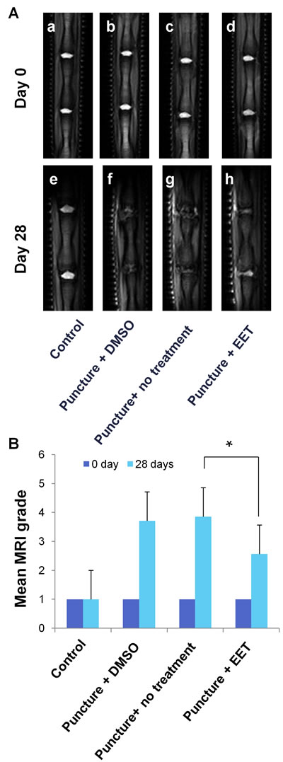 EET improves MRI disc grade.