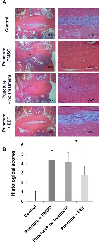 EET preserves disc structure.