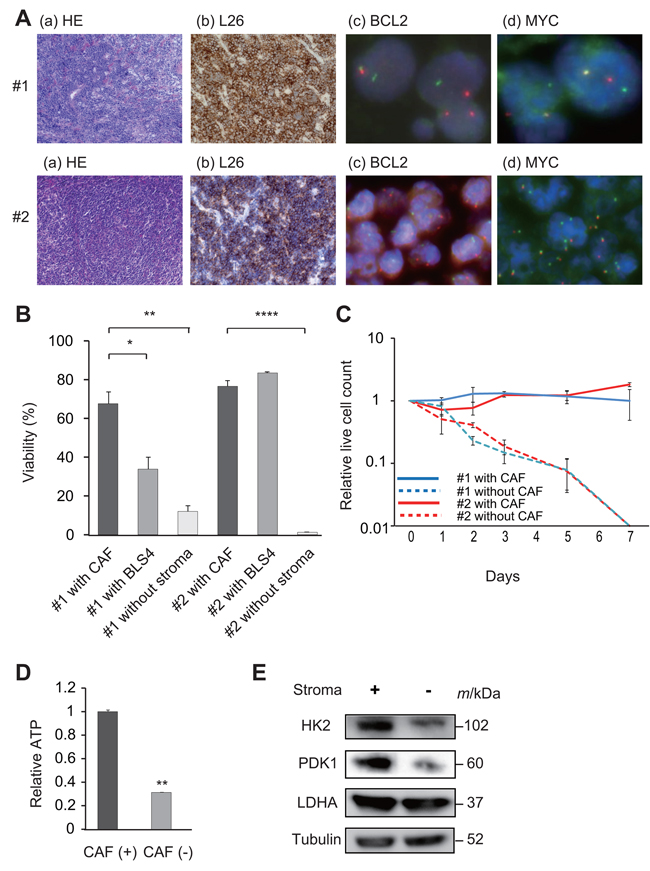Establishment of ex vivo culture of primary lymphoma cells using CAF.