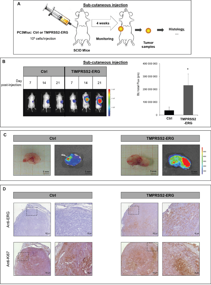 TMPRSS2-ERG fusion increases subcutaneous tumor growth.