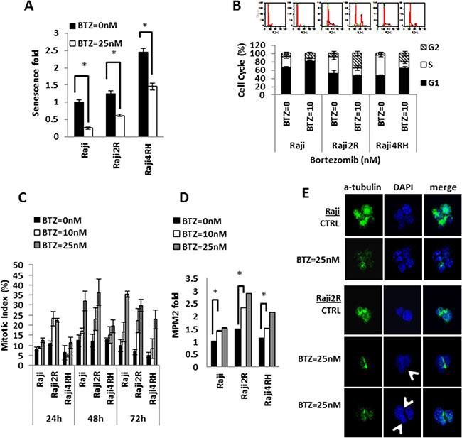 Bortezomib exposure results in variable degrees of senescence inhibition, G2/M arrest and mitotic catastrophe in RSCL and RRCL.