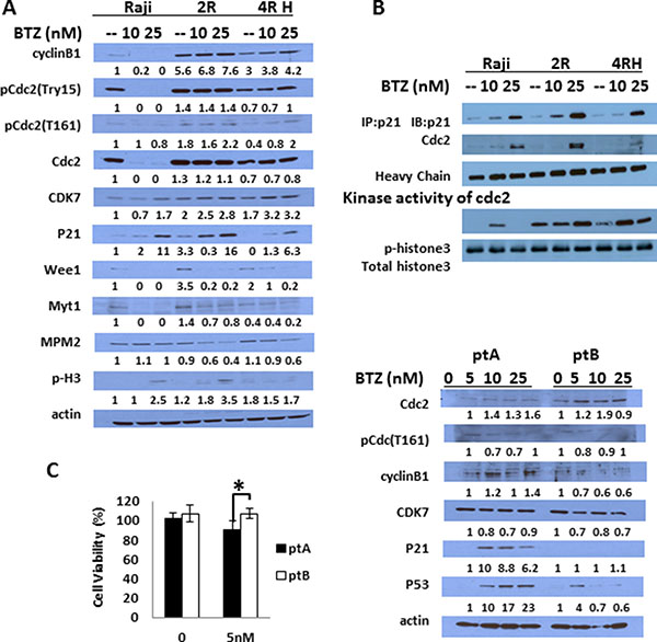 BTZ causes different effects on cell cycle regulated proteins and apoptosis proteins in RSCL and RRCL.