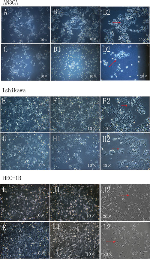 Morphological changes in Ishikawa, HEC-1B and AN3CA cells following DPPIV overexpression or knockdown.