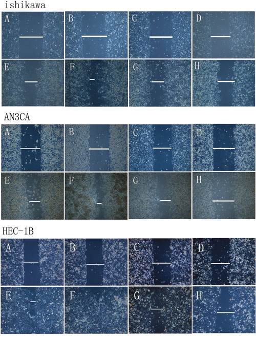 Analysis of migration in DPPIV-overexpressing or knockdown cells.