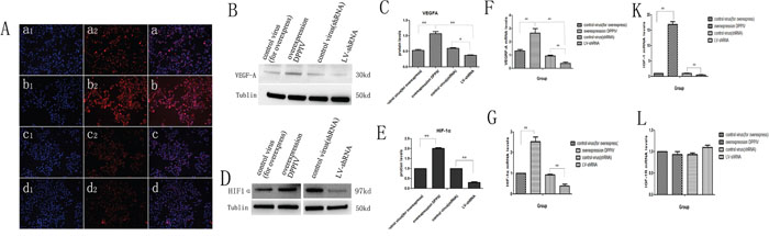 In AN3CA cells, DPPIV overexpression increase the protien and mRNA expression of HIF-1&#x03B1; and VEGFA; DPPIV overexpression inceases the mRNA expression of IGF-1, but not IGF-1R.