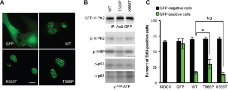 Effect of the T566P mutation on cellular localization, HIPK2 kinase activity, and cell proliferation.