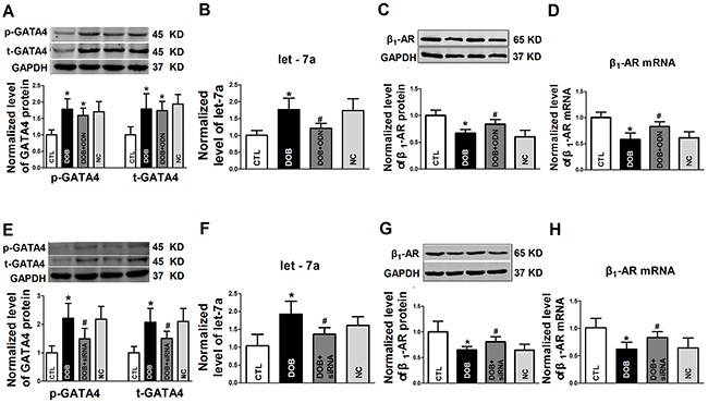 The role of GATA4 on &#x03B2;1-AR activation in regulation of expression of let-7a and &#x03B2;1-AR in NRVCs.