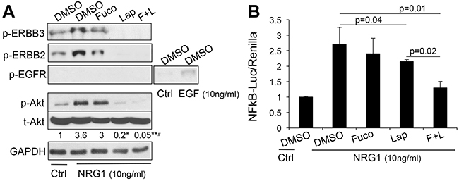 The combination lapatinib-fucoidan enhances the inhibition of AKT and NF&#x03BA;B.