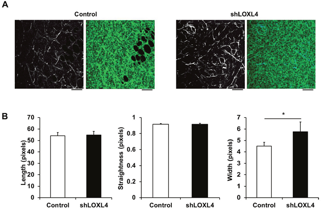 Second harmonic generation (SHG) imaging of control and LOXL4-knockdown primary tumor tissues.