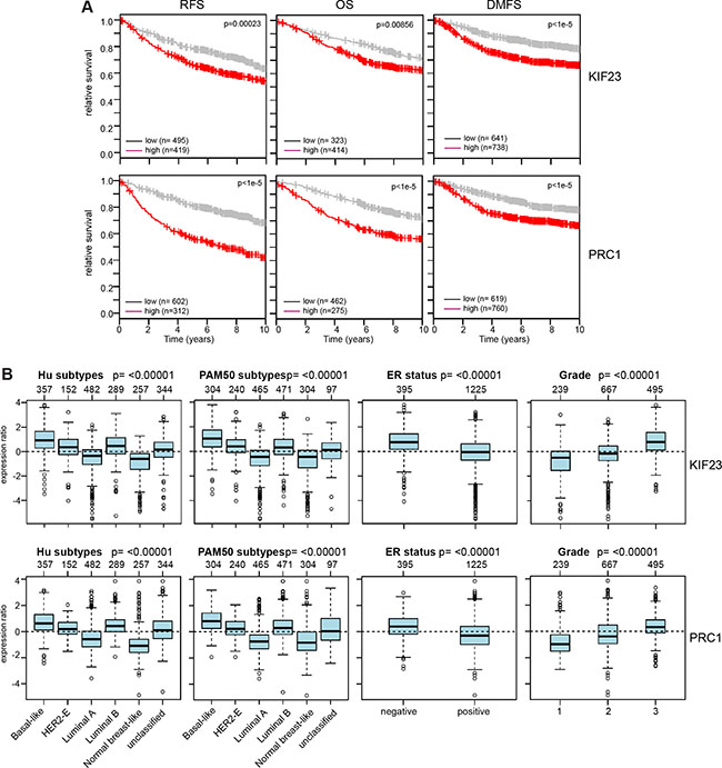 Clinical relevance of KIF23 and PRC1 expression in breast cancer.