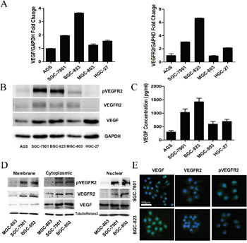 Differential Expression of VEGF, pVEGFR2, and VEGFR2 in gastric cancer cell lines.