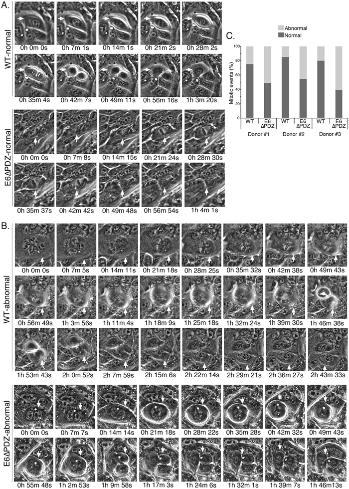 Live cell microscopy shows that loss of E6 PBM function is associated with an increase in abnormal mitoses in viral genome-containing cells.