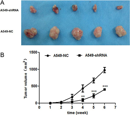Effect of B7-H4shRNA on lung cancer in vivo.