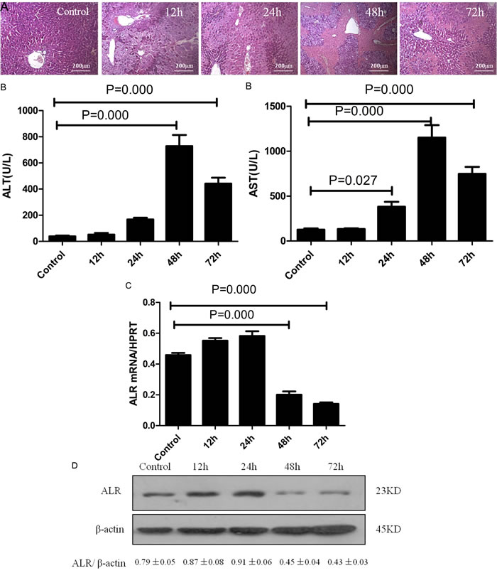 ALR expression is significantly decreased during the late stage in mice with CCl