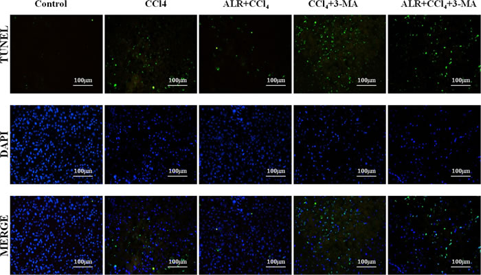 ALR suppresses apoptosis in mice with CCl