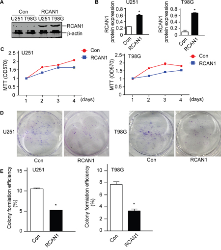 RCAN1 decreased cell viability in glioma cell lines.