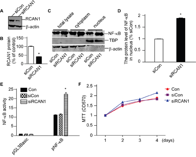 RCAN1 suppressed viability of glioma cells through inhibiting NF-&#x03BA;B signaling pathway.