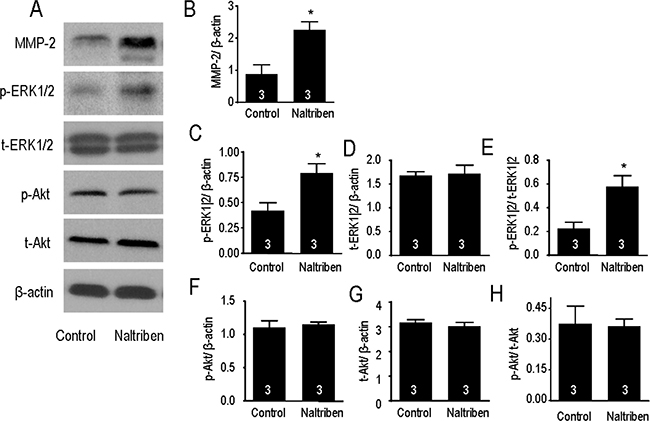 Naltriben upregulated the expression of MMP-2, and increased the phosphorylation of ERK1/2 in U87 cells.