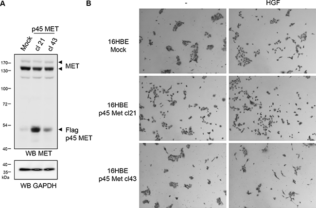 p45 MET fragment favors cell scattering of 16HBE epithelial cells.