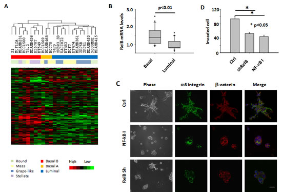 Expression of disorganization genes and activation of the NF-&#x3ba;B pathway are associated with aggressive 3D phenotypes of multiple breast cancer cell lines.