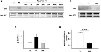 The NFkB pathway is activated in disorganized T4-2 cells compared to polarized S1 and reverted T4 cells.