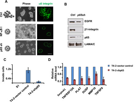 Inhibition of the NFkB pathway reverses the malignant phenotypes of T4-2 cells in 3D culture.