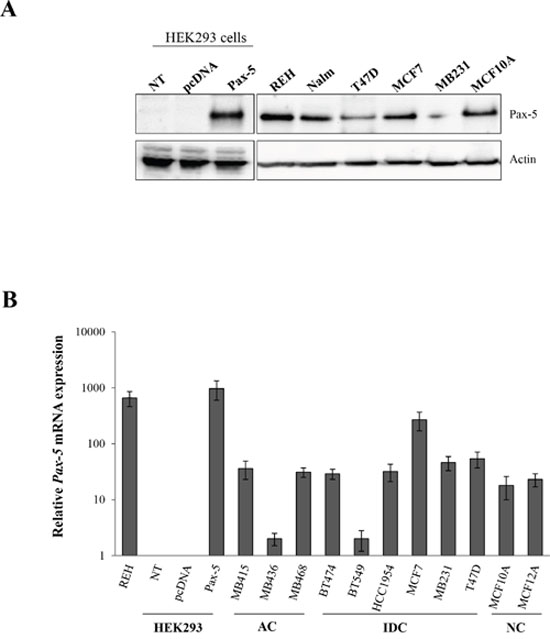 Relative Pax-5 expression in breast cancer cell lines.