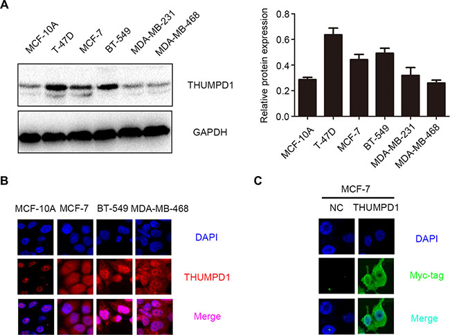 THUMPD1 expression and subcellular localization in breast cancer cell lines.