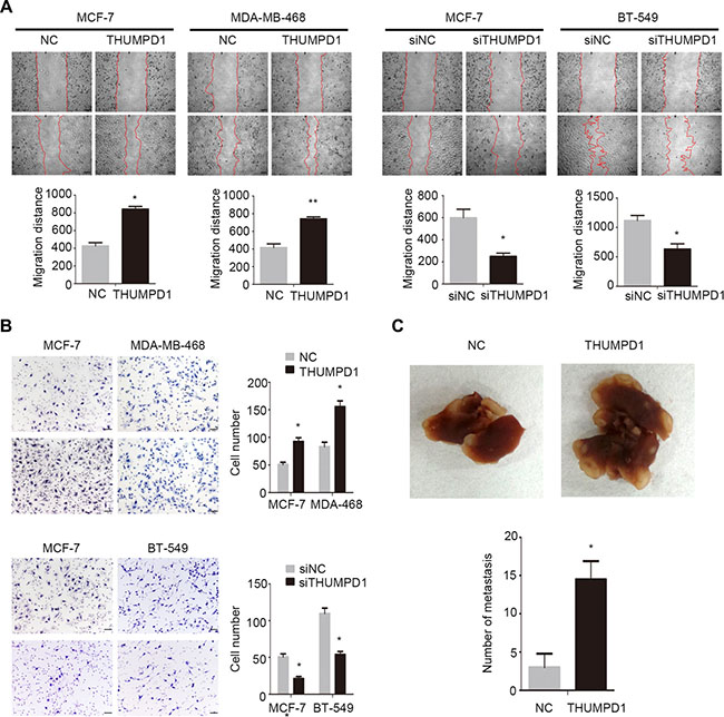 THUMPD1 enhanced breast cancer cell invasion and migration in vivo and in vitro.