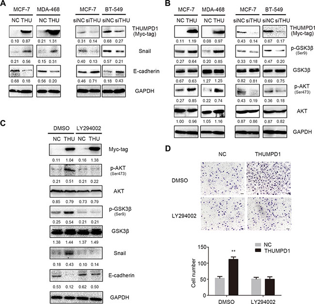 THUMPD1 promoted cancer cell invasion and migration via the AKT-GSK3&#x03B2;-Snail pathway.