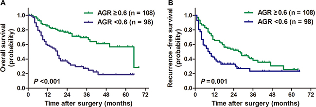 Kaplan-Meier survival curves for patients with ICC stratified by AGR.