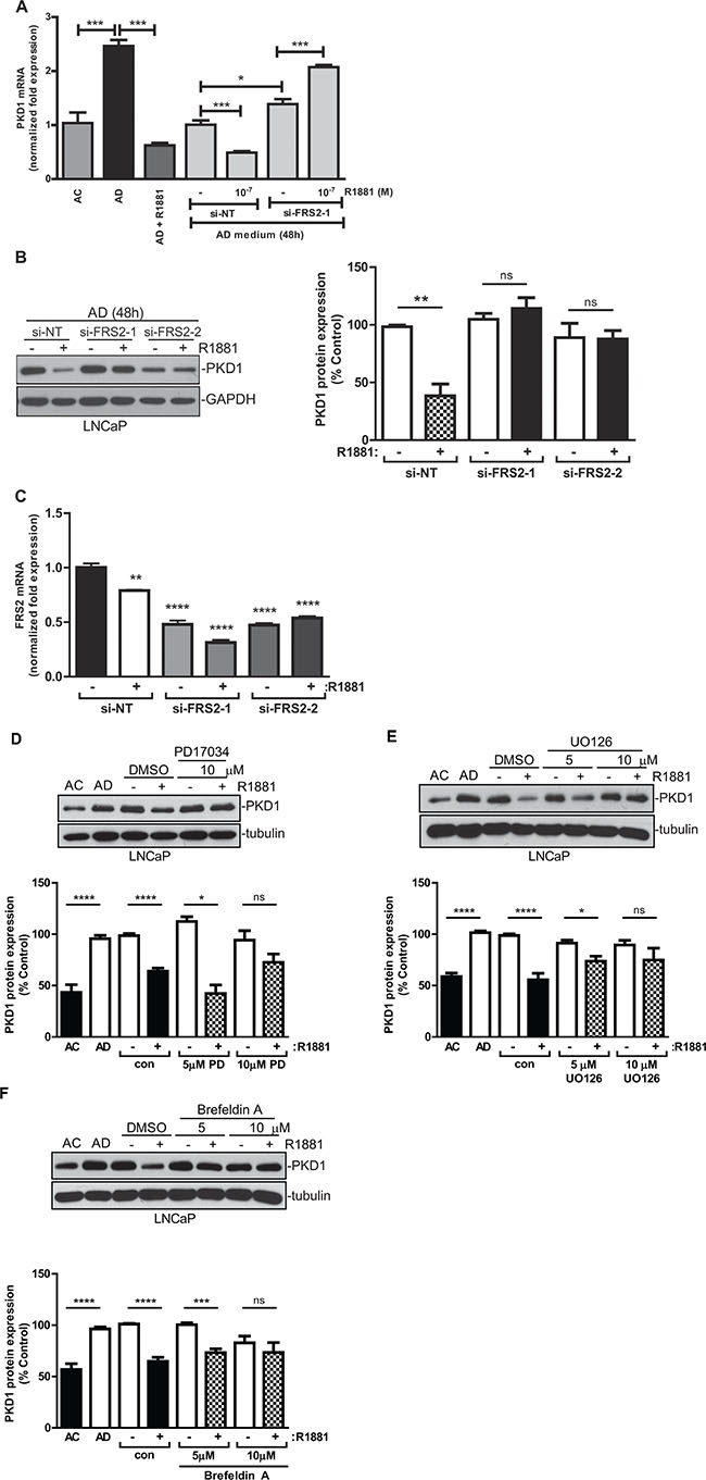 FRS2 was required for androgen-induced PKD1 repression.